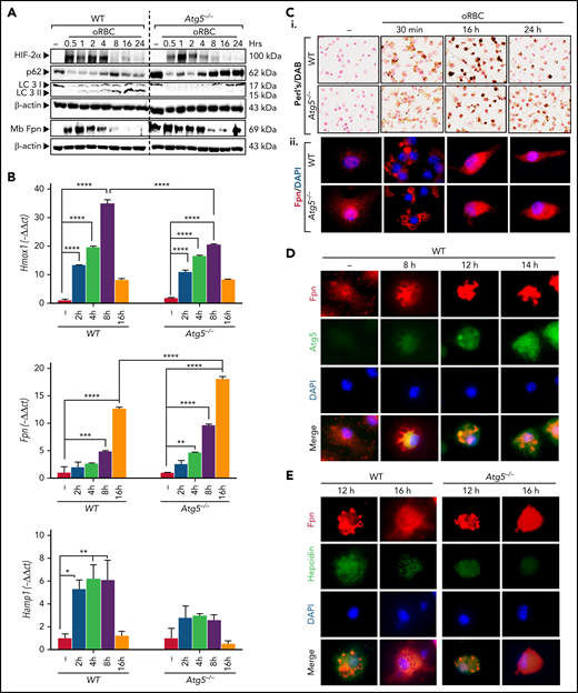 Erythrophagocytosis activates autophagy in BMDMs, and autophagy deficiency in BMDMs abrogates ferroportin degradation. (A) Expression kinetics in BMDMs treated with oRBCs. Atg5−/− and WT BMDMs were incubated with oRBCs (oRBCs to cells, 5:1) for the indicated times. Western blot analysis of Hif2α, p62, and LC3 from total protein extracts and Fpn from membrane extracts, and β-actin as control, in BMDMs from LysM-Atg5−/− and WT mice incubated with oRBCs (oRBCs to cells, 5:1) for the indicated times. After treatment with oRBCs, protein was extracted from BMDMs for western blot analysis (representative analysis of n = 3 independent experiments is shown; quantitative analysis of the western blots is given in supplemental Table 4). (B) Kinetics of Hmox1, Fpn, and Hamp1 mRNA expression in BMDMs treated with oRBCs. Representative mRNA fold changes (relative to Gapdh) expressed as −ΔΔCt values (n = 3 replicates). Data are presented as means and standard errors. (C) Iron loading and ferroportin localization in BMDMs from LysM-Atg5−/− and WT mice treated with oRBCs. (Ci) Representative images of Perl’s/DAB iron–stained BMDMs (NanoZoom scan imaging; original magnification, 40×). BMDMs cultured on slides incubated for the indicated times after treatment with oRBCs (oRBCs to cells, 5:1) were fixed with paraformaldehyde for immunostaining or with methanol for Perl’s staining followed by DAB enhancement. (Cii) Detection of ferroportin by immunofluorescence in BMDMs from LysM-Atg5−/− and WT mice. Images are composites of ferroportin (red) and 4′,6-diamidino-2-phenylindole (DAPI)–stained nuclei (blue) (Leica fluorescence microcopy imaging; original magnification, 100×; representative images shown are from n = 4 independent experiments). (D) Immunofluorescence colocalization of ferroportin in BMDMs from WT mice treated with oRBCs. WT BMDMs were double labeled with a rabbit anti-Fpn antibody and Alexa Fluor 488–conjugated secondary donkey anti-rabbit immunoglobulin G (IgG; red), followed by rabbit anti-Atg5 antibody and TRITC-conjugated goat secondary anti-rabbit IgG (green). Cell nuclei were stained with DAPI (blue). Erythrophagocytosis resulted in colocalization of ferroportin and Atg5 in erythrophagocytic BMDMs at 8 to 16 hours (Leica fluorescence microcopy imaging; original magnification, 40×; representative images shown are from n = 2 independent experiments). (E) Immunofluorescence colocalization of ferroportin and hepcidin in BMDMs from LysM-Atg5−/− and WT mice treated with oRBCs. WT and Atg5−/− BMDMs were double labeled with a rabbit antiferroportin antibody and Alexa Fluor 488–conjugated secondary donkey anti-rabbit IgG (red), followed by rabbit antihepcidin antibody58 and TRITC-conjugated secondary goat anti-rabbit IgG (green). Cell nuclei were stained with DAPI (blue). Erythrophagocytosis resulted in colocalization of ferroportin and hepcidin in WT cells at 12 hours and Atg5−/− cells at 16 hours (Leica fluorescence microcopy imaging; original magnification, 40×; representative images shown are from n = 2 independent experiments). *P < .05, **P < .01, ***P < .001, ****P < 10−4.