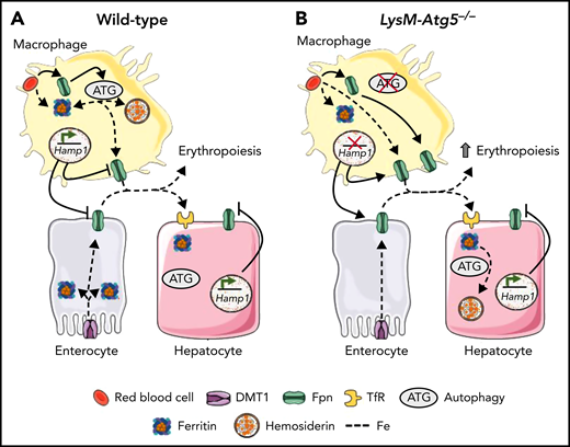 Schematic figure of key similarities and differences between WT and LysM-Atg5−/− mice. (A) WT mice. Erythrocytes are phagocytosed by macrophages. Macrophages efficiently recycle phagocytosed iron to transferrin in the circulation, and with the help of autophagy (ATG), the excess iron is stored in hemosiderin. A small amount of iron uptake by enterocytes is released from enterocytes; most is stored in ferritin. Tranferrin-bound iron is carried to BM. Iron is incorporated into newly formed erythrocytes within the BM. Hepcidin produced from hepatocytes and macrophages controls cell iron release. (B) LysM-Atg5−/− mice. Erythrocytes are phagocytosed by macrophages. Macrophages efficiently recycle phagocytosed iron to transferrin in the circulation, but without functional ATG, ferroportin from RBCs cannot be sufficiently degraded, and the excess iron cannot be stored in hemosiderin. High iron release from macrophages decreases hepcidin expression. A large amount of iron is released from macrophages and absorbed from enterocytes. Tranferrin-bound iron is carried in excess to BM and extramedullary sites of erythropoiesis. Iron is incorporated into an excess of newly formed erythrocytes. Dashed lines indicate iron transit.