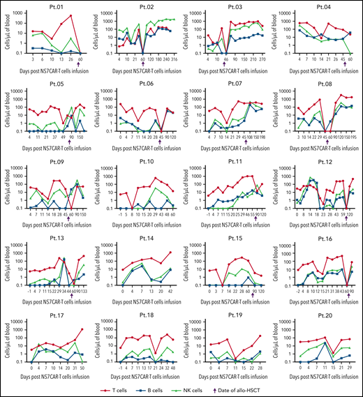 The dynamics of the absolute count of the T, B, and NK cells among individual patients after NS7CAR T-cell infusion and allo-HSCT. The absolute numbers of T, B, and NK cells of each patient were measured after NS7CAR T-cell therapy. CAR T and malignant T cells were excluded from T-cell counting. The absolute numbers of T/B/NK cells showed a temporary decline, to varying levels, for each patient during the peak of CAR-T proliferation. T/B/NK cells then recovered to the baseline levels but decreased shortly again after allo-HSCT. The 4 patients (Pt.05, Pt.07, Pt.11, and Pt.15) missed the time window for blood check within the 1 week after transplant to observe the decline in T and NK cells. There was an adequate recovery of normal T and NK cells after allo-HSCT.