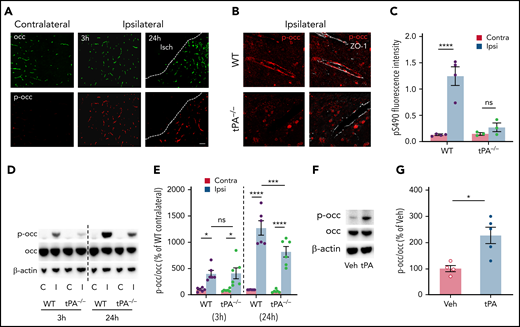 MCAO induces occludin S490 phosphorylation in a tPA-dependent manner. Mice were subjected to MCAO and killed at 3 and 24 hours after MCAO. (A) Stitched images of the region adjacent to the ischemic core (Isch) showing vessel pS490 occludin (red) and total occludin (green) staining in WT mice compared with contralateral hemisphere. Scale bar, 60 µm. (B) Confocal images zoomed in on individual vessels showing pS490 occludin (red) and ZO-1 (white) staining in tPA−/− mice after MCAO compared with WT mice 24 hours’ post-MCAO. Scale bar, 17 µm. (C) Quantification of pS490 fluorescence intensity at the junction 24 hours after MCAO in WT and tPA−/− mice in the contralateral (Contra) and ipsilateral (Ipsi) regions. (D) The amount of pS490 and total occludin in extracts from the ipsilateral (I) and contralateral (C) hemispheres was determined by western blot in WT and tPA−/− mice at 3 and 24 hours’ post-MCAO. (E) Quantification is expressed as relative to WT contralateral from each time point. (F) ICV injection with either PBS or tPA was performed in WT mice; after 6 hours, protein levels of pS490 and total occludin were determined by western blot of the whole brain extract. (G) Quantification is shown. One-way analysis of variance followed by Holm-Šídák post hoc test was used for comparison of ≥3 groups; a t test was used for comparison between 2 groups. *P < .05, ***P < .001, ****P < .0001. ns, nonsignificant; Veh, vehicle.