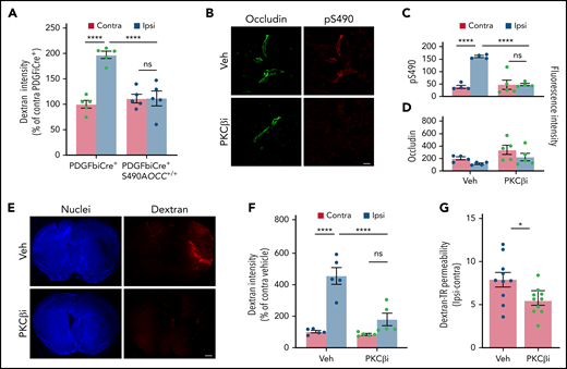 Inhibition of occludin S490 phosphorylation prevents MCAO-induced permeability. (A) PDGFiCre+ mice and PDGFiCre+; S490AOCC+/+ mice were subjected to MCAO, and BBB permeability was determined 24 hours later by quantifying a 70-kDa fluorescent dextran leak in cross-sections from both the ipsilateral (Ipsi) and the contralateral (Contra) region. (B) WT mice were given vehicle (Veh) or the PKCβ inhibitor (PKCβi; 10 mg/kg) once a day for 3 days and then subjected to MCAO followed by one additional dose of the inhibitor 1 hour later. pS490 occludin (red) and total occludin (green) were detected by immunostaining in brain sections 24 hours after MCAO. Scale bar, 25 µm. Quantification of pS490 at the junction (C) and total occludin from confocal images (D) 24 hours after MCAO. (E) Image of BBB permeability to 70-kDa dextran in entire coronal sections in both contralateral and ipsilateral hemispheres 24 hours after MCAO. Scale bar, 600 µm. (F) Quantification of dextran leak in cross-sections 24 hours after MCAO. (G) BBB permeability to 70-kDa dextran was also assessed by quantifying the amount of extravasated dye in brain homogenates 24 hours after MCAO. One-way analysis of variance followed by a Holm-Šídák post hoc test. *P < .05, ****P < .0001. ns, nonsignificant.