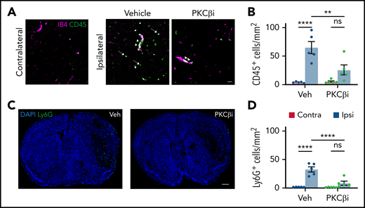 PKCβ inhibition reduces MCAO-induced inflammation. Mice were treated with either vehicle (Veh) or the PKCβ inhibitor (PKCβi; 10 mg/kg) once a day for 3 days and then subjected to MCAO followed by 1 additional dose of the inhibitor 1 hour later. (A) Twenty-four hours after MCAO, representative confocal images were obtained from the contralateral and ipsilateral (ischemic core) regions stained with vessel marker IB4 (purple) and leukocyte marker CD45 (green) showing leukostasis (arrowheads) and infiltration of CD45+ cells to the parenchyma (arrows). Scale bar, 30 µm. (C) Stitched confocal images of the whole brain section showing the contralateral region on the left and ipsilateral on the right, stained with neutrophil marker Ly6G (green) and nuclei marker 4′,6-diamidino-2-phenylindole (DAPI; blue). Scale bar, 500 µm. The number of CD45+ (B) and Ly6G+ (D) cells was counted in both contralateral (red bars) and ipsilateral (blue bars) hemispheres. Data are represented as mean ± standard error of the mean. One-way analysis of variance followed by a Holm-Šídák post hoc test. **P < .01, ****P < .0001. ns, nonsignificant.