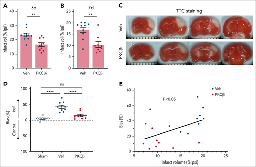 PKCβ inhibition decreases infarct volume and improves functional outcome. WT mice were given vehicle or the PKCβ inhibitor (PKCβi; 10 mg/kg) once a day for 3 days and then subjected to MCAO followed by 3 additional daily doses of the inhibitor. Infarct volume was assessed by using 2,3,5-triphenyltetrazolium chloride (TTC) staining at 72 hours (A) and 7 days (B) after MCAO. (C) Representative images of TTC staining 7 days after MCAO. (D) Functional outcome was measured by assessing the lateralized bias in the corridor test 7 days after MCAO. (E) Pearson’s correlation between the lateralized bias and infarct volume in vehicle- and PKCβi-treated mice, 7 days after MCAO. One-way analysis of variance followed by a Holm-Šídák post hoc test was used for comparison of ≥3 groups; a t test was used for comparison between 2 groups. **P < .01, ****P < .0001. Contra, contralateral; Ipsi, ipsilateral; ns, nonsignificant; Veh, vehicle.