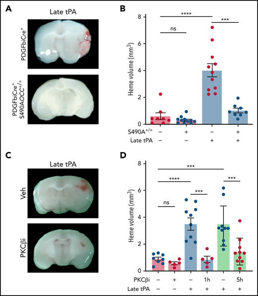Inhibition of PKCβ prevents hemorrhagic transformation after delayed tPA treatment. (A) PDGFiCre+ mice and PDGFiCre+; S490AOCC+/+ mice were subjected to MCAO and then treated intravenously with either PBS or tPA (10 mg/kg) 5 hours after MCAO. (B) The volume of hemorrhage was quantified from serial brain sections 72 hours after MCAO. (C) Mice were subjected to MCAO; 1 hour (light blue bars) or 5 hours (green bars) later, animals were treated with vehicle (Veh) or PKCβ inhibitor (PKCβi; 10 mg/kg) daily for 3 days. Delayed tPA thrombolysis was performed 5 hours after MCAO, and brains were analyzed at 72 hours after MCAO. (D) Hemorrhage volume was measured 72 hours after MCAO. One-way analysis of variance followed by a Holm-Šídák post hoc test was used for comparison of ≥3 groups; a t test was used for comparison between 2 groups. ***P < .001, ****P < .0001. ns, nonsignificant.