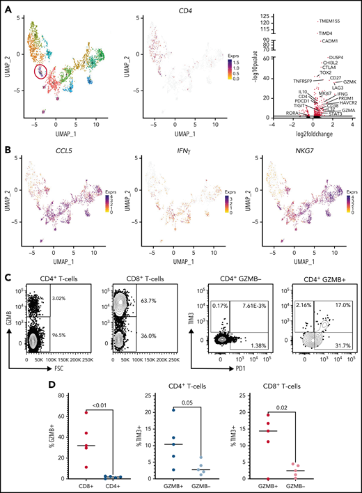 Helper/cytotoxic exhausted CD4+ T cells are observed in human patients with B-ALL. (A) UMAP plot of CD3+ T cells sorted from diagnostic bone marrow biopsy samples of 5 patients with B-ALL. A population of CD4+ T cells expressing markers of cytotoxicity was identified (red circle; left panel). Feature plot showing CD4 expression (middle panel). The volcano plot illustrates significantly differentially expressed genes between this cluster (n = 69 cells) as compared with all others (n = 2442 cells); transcripts identified with a false discovery rate (FDR) >2 are highlighted in red (right panel). (B) Feature plots showing expression of CD4, CCL5, IFNG, and NKG7. (C) Representative plots using flow cytometry to profile the frequency of GZMB+ cells between CD4+ and CD8+ T cells (left panels) and the relative distribution of TIM3 positivity in either GZMB− or GZMB+ cells (right panels). (D) Graphs showing the frequency of GZMB+ cells in CD4+ and CD8+ T cells and the relative distribution of TIM3+ events in either GZMB− or GZMB+ cells. The median is displayed, and statistical significance was determined using an unpaired t-test. The data from diagnostic samples from 5 patients are summarized.