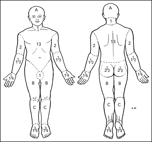 Regional areas of the body for assessment of total body skin lesions. Body region percent BSA for mSWAT determination by Lund and Browder.30 A, B, and C designate the body regions of head, thigh, and leg, respectively, for which they provided adjustments in BSA for children aged 1 to 5 years.