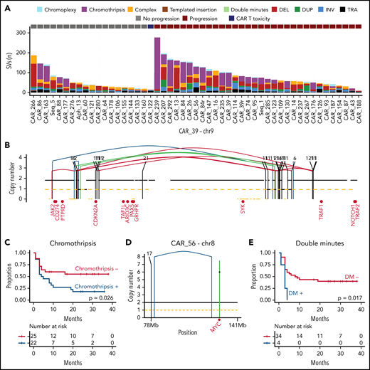 The landscape of structural variants in r/r LBCL and outcome association. (A) Stacked bars show the genome-wide burden of each SV class and complex event per each sample (x-axis, 51 WGS samples from 49 patients). (B) Copy number profile plot integrated with SV information showing an emblematic example of chromothripsis on chromosome 9 responsible of CDKN2A loss (sample CAR_39). The horizontal black line indicates the total copy number; the dashed orange line indicates the minor copy number. The vertical lines represent SV breakpoints, color-coded based on SV class. Red text represents the DLBCL driver genes present on chromosome 9. (C) Kaplan-Meier plot for PFS comparing patients with LBCL, with and without chromothripsis (n = 47) (D-E) Examples of double minutes involving MYC (D) and Kaplan-Meier plot for PFS, comparing patients with DLBCL, with and without double minutes (n = 38).