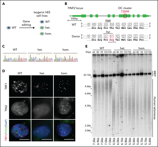 Endogenous TINF2-DC mutation leads to the short telomere patient phenotype in hESCs. (A) Experimental overview: generation of isogenic hESC lines. (B) Schematic of TINF2 locus editing by inducing CAS9-mediated double-strand break and homologous recombination in the presence of a repair template including the desired mutation. Successful targeting results in the ablation of the PAM site and de novo generation of a StyI site. (C) Sanger sequencing chromatogram of PCR amplicons of genomic DNA from the WT, heterozygous (het WT/T284R), and homozygous (hom T284R/T284R) hESC lines. (D) IF staining of telomere-binding proteins TRF1 (red) and TIN2 (green) in the WT, het, and hom hESCs. DNA was stained with 4,6-diamino-2-phenylindole (DAPI; blue). Scale bar, 10 μm. (E) Telomere length analysis of WT, het, and hom hESCs at indicated time points after targeting.
