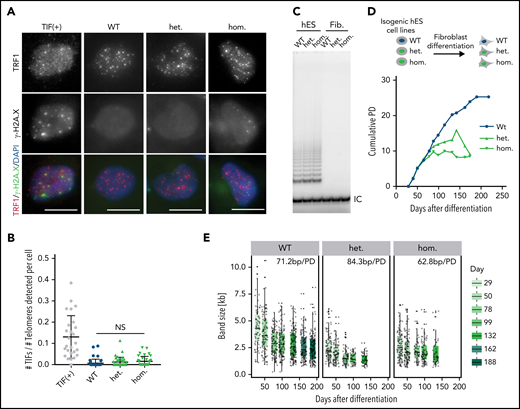 Telomere shortening occurs in the TINF2-DC stem cells and reduces the proliferative capacity of differentiated cells. (A) IF staining of TRF1 (red) and γ-H2A.X (green) of WT, heterozygous, and homozygous hESCs. TIF (+): positive control. DNA was stained with DAPI (blue). Scale bar, 10 μm. (B) Quantification of the number of TIFs detected per telomeres per cell. Mann-Whitney test. NS: P > .05. (C) Telomerase repeat amplification assay of the indicated cell lines as hESCs or fibroblasts 30 days after differentiation. IC, internal control. (D) Experimental overview of fibroblast differentiation and growth curves of cumulative population doublings (PDs) over days after differentiation. The isogenic fibroblasts lines were serially passaged until they reached replicative senescence. (E) Quantification of the size of TeSLA PCR products (n = 8) of fibroblasts at indicated time points after differentiation and telomere shortening rate in base pairs per PD (bp/PD).