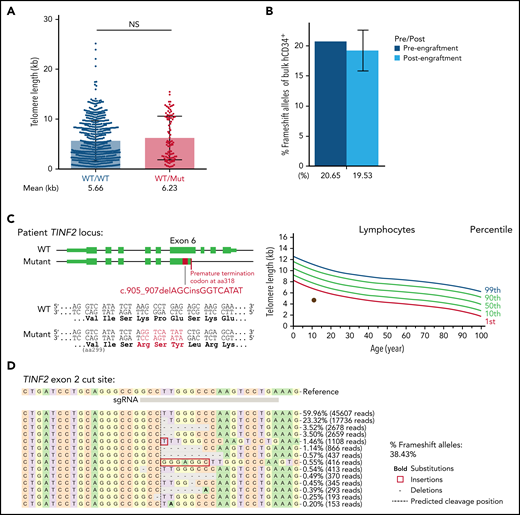 TINF2 disruption at exon 2 in donor and patient HSPCs. (A) Telomere length analysis of colonies plotted by genotype at TINF2 exon 2. Mann-Whitney test. NS: P > .05. (B) Percentages of frameshift alleles of bulk hCD34+ cells before and after engraftment in NBSGW mice. Error bars indicate data point ranges of 2 biological replicates. (C) A schematic of the patient TINF2 locus with c.905_907delAGCinsGGTCATAT mutation (left). Lymphocyte telomere length (kb) according to age in the patient (right, brown dot). (D) Allele distributions of the patient CD34+ cells 5 days after nucleofection.