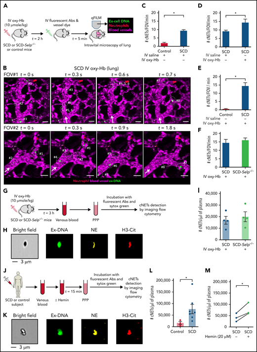 Embolic NETs arrive in the lung from other organs, in a P-selectin–independent manner in SCD. (A) Experimental scheme used in panels B to E: Control, SCD, or SCD-Selp−/− mice were IV administered 10 µmol/kg oxy-Hb or saline, and qFILM was used to assess the absence or presence of cNETs within the pulmonary microcirculation. Pulmonary microcirculation (pseudo-colored purple), neutrophils (pseudo-colored red), and extracellular DNA (pseudo-colored green) were labeled in vivo by IV administration of FITC dextran, Pacific blue–anti-Ly6G Ab and Sytox orange, respectively. (B) Two representative qFILM FOVs (#1 and #2) showing several cNETs (green fragments marked with white circles) entering the lung microcirculation (purple) via the pulmonary arteriole at different time points in mice with SCD administered IV oxy-Hb. FOV#1 (top row): cNETs #1, #2, and #3 entered via the pulmonary arteriole (diameter ∼28 μm) at 0 seconds, cNETs #1, #2 left the FOV and #4, #5, #6 entered the FOV at 0.3 seconds, cNET #3 left the FOV at 0.6 seconds, cNETs #4, #5, #6 left the FOV, and #7, #8 entered the FOV at 0.7 seconds. FOV#2 (bottom row): cNETs #1, #2 entered the FOV via the pulmonary arteriole (diameter ∼24 μm) at 0 seconds, cNETs #3, #4 entered the FOV at 0.3 seconds, cNETs #1, #2, #3, #4 left the FOV and #5, #6, #7 entered the FOV at 0.9 seconds, cNETs #5, #6 left the FOV and #8 entered the FOV at 1.8 seconds. Time points are relative to the first frame shown at t = 0 seconds. Complete time series shown in supplemental Videos 8 and 9. White arrows denote the direction of blood flow within the pulmonary arterioles. Scale bars, 20 µm. (C-F) Number of cNETs entering per FOV over a 1-minute duration (#cNETs/FOV/min) were quantified using strategy described in supplemental Methods. (C) #cNETs/FOV/min were significantly more numerous in mice with SCD than control mice administered IV saline. #cNETs/FOV/min were significantly more numerous in mice with SCD administered IV oxy-Hb than (D) mice with SCD administered IV saline or (E) control mice administered IV oxy-Hb, but not different from (F) SCD-Selp−/− mice administered IV oxy-Hb. Control IV saline (n = 3 mice; 28 FOVs), SCD IV saline (n = 4 mice; 51 FOVs), SCD IV oxy-Hb (n = 4 mice; 44 FOVs), control IV Oxy-Hb (n = 4 mice, 43 FOVs), SCD-Selp−/− IV oxy-Hb (n = 5 mice; 71 FOVs). qFILM FOV size∼65 536 µm2. (G) Experimental scheme used in panels H to I: SCD or SCD-Selp−/− mice were IV administered 10 µmol/kg oxy-Hb; venous blood was processed to generate platelet poor plasma (PPP). PPP was incubated with Sytox green and fluorescent Abs against NE and citrullinated-histones (H3-Cit), and used for detection of cNETs by imaging flow cytometry as described in supplemental Methods. (H) A representative imaging flow cytometry image of a cNET in the blood of mice with SCD administered IV oxy-Hb. cNETs were identified as particles (<3 μm) triple-positive for NETs markers–extracellular DNA (green), NE (pseudo-colored yellow), and H3-Cit (pseudo-colored red). Scale bar, 3 µm. (I) Imaging flow cytometry data were quantified as described in supplemental Methods to estimate concentration of cNETs (#cNETs/μL of plasma). Plasma concentration of cNETs was not different between SCD and SCD-Selp−/− mice (n = 4 mice per group) administered IV oxy-Hb. (J) Experimental scheme used in panels K to M: control or SCD human blood with or without incubation with 20 μM hemin processed to generate PPP and cNETs detected using Imaging Flow Cytometry as in panel G. (K) A representative imaging flow cytometry image of a cNET in a patient’s blood with SCD. Scale bar, 3 µm. (L) The concentration of cNETs was significantly higher in untreated SCD (n = 7) than control (n = 3) human subjects’ blood. (M) Incubation with hemin significantly increased cNETs concentration in patients’ blood with SCD (n = 3). Straight line connects cNETs concentrations in the same patient’s blood with SCD pre- (blue circle) and post- (green circle) hemin treatment. Data in panels C-E, F, I, L represent mean ± SE and compared using Student t test. Data in panel M were compared using a paired Student t test. *P < .05.