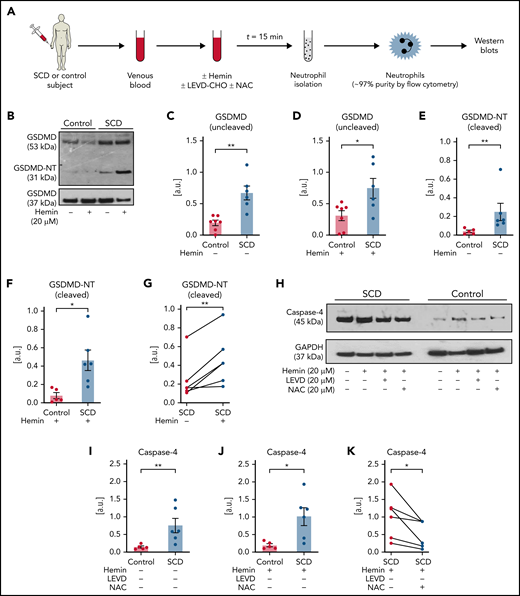 Inflammatory milieu in SCD promotes caspase-4–dependent activation of neutrophil-GSDMD. (A) Experimental scheme: control or SCD human blood with or without preincubation (15 minutes) with 20 μM hemin or 20 μM hemin + 20 μM caspase-4 inhibitor (LEVD-CHO) or 20 μM hemin + 20 μM antioxidant NAC was used for neutrophil isolation. Neutrophil purity was confirmed (∼97%) using flow cytometry, and neutrophils were used in western blot analysis. Refer to supplemental methods for details. (B) Representative western blot micrograph shows both uncleaved GSDMD (53 kDa) and the cleaved GSDMD-NT (31 kDa) present in patient neutrophils with SCD but only uncleaved GSDMD present in control human neutrophils. (C-G) Densitometric analyses of western blot micrographs (representative example shown in panel B) revealed significantly higher (C) GSDMD in neutrophils isolated from untreated SCD than control human blood, (D) GSDMD in neutrophils isolated from hemin treated SCD than control human blood, (E) GSDMD-NT in neutrophils isolated from untreated SCD than control human blood, (F) GSDMD-NT in neutrophils isolated from hemin treated SCD than control human blood, and (G) GSDMD-NT in neutrophils isolated from hemin-treated than untreated blood of same patients with SCD. Data representative of 7 control and 6 SCD human subjects (C, D), 5 control and 6 SCD human subjects (E, F), and 6 SCD human subjects (G). (H) Representative western blot micrograph and (I-K) densitometric analyses show significantly higher levels of caspase-4 (45 kDa) in neutrophils isolated from (I) untreated SCD than control human blood, (J) hemin-treated SCD than control human blood, and (K) hemin-treated than hemin + NAC-treated blood of same patients with SCD. Data representative of 5 control and 6 SCD human subjects (I-J) and 6 SCD human subjects (K). (L) Representative western blot micrograph and (M-N) densitometric analyses show significantly higher GSDMD-NT (31 kDa) in neutrophils isolated from (M) hemin-treated than hemin + LEVD-CHO–treated blood of same patients with SCD and (N) hemin-treated than hemin + NAC–treated blood of same patients with SCD. Data in panels M-N representative of 6 SCD human subjects. Pre- and posttreatment data point of each SCD human subject connected by a straight line in panels G, K, M, and N. Each data point in panels C-F and I-J represents a separate human subject. Mean ± SE shown in panels C-F and I-J compared using Student t test. Data in panels G, K, and M-N compared using paired Student t test. *P < .05; **P < .01. glyceraldehyde-3-phosphate dehydrogenase (GAPDH; 37 kDa) was used as the loading control. Uncropped images of western blot micrographs panels B, H, and L shown in supplemental Figures 18-20, respectively.