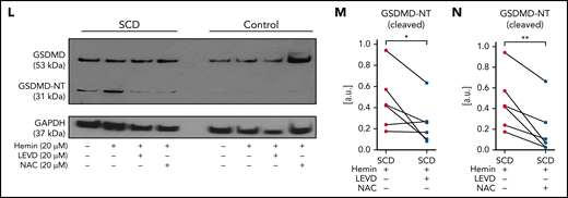 Inflammatory milieu in SCD promotes caspase-4–dependent activation of neutrophil-GSDMD. (A) Experimental scheme: control or SCD human blood with or without preincubation (15 minutes) with 20 μM hemin or 20 μM hemin + 20 μM caspase-4 inhibitor (LEVD-CHO) or 20 μM hemin + 20 μM antioxidant NAC was used for neutrophil isolation. Neutrophil purity was confirmed (∼97%) using flow cytometry, and neutrophils were used in western blot analysis. Refer to supplemental methods for details. (B) Representative western blot micrograph shows both uncleaved GSDMD (53 kDa) and the cleaved GSDMD-NT (31 kDa) present in patient neutrophils with SCD but only uncleaved GSDMD present in control human neutrophils. (C-G) Densitometric analyses of western blot micrographs (representative example shown in panel B) revealed significantly higher (C) GSDMD in neutrophils isolated from untreated SCD than control human blood, (D) GSDMD in neutrophils isolated from hemin treated SCD than control human blood, (E) GSDMD-NT in neutrophils isolated from untreated SCD than control human blood, (F) GSDMD-NT in neutrophils isolated from hemin treated SCD than control human blood, and (G) GSDMD-NT in neutrophils isolated from hemin-treated than untreated blood of same patients with SCD. Data representative of 7 control and 6 SCD human subjects (C, D), 5 control and 6 SCD human subjects (E, F), and 6 SCD human subjects (G). (H) Representative western blot micrograph and (I-K) densitometric analyses show significantly higher levels of caspase-4 (45 kDa) in neutrophils isolated from (I) untreated SCD than control human blood, (J) hemin-treated SCD than control human blood, and (K) hemin-treated than hemin + NAC-treated blood of same patients with SCD. Data representative of 5 control and 6 SCD human subjects (I-J) and 6 SCD human subjects (K). (L) Representative western blot micrograph and (M-N) densitometric analyses show significantly higher GSDMD-NT (31 kDa) in neutrophils isolated from (M) hemin-treated than hemin + LEVD-CHO–treated blood of same patients with SCD and (N) hemin-treated than hemin + NAC–treated blood of same patients with SCD. Data in panels M-N representative of 6 SCD human subjects. Pre- and posttreatment data point of each SCD human subject connected by a straight line in panels G, K, M, and N. Each data point in panels C-F and I-J represents a separate human subject. Mean ± SE shown in panels C-F and I-J compared using Student t test. Data in panels G, K, and M-N compared using paired Student t test. *P < .05; **P < .01. glyceraldehyde-3-phosphate dehydrogenase (GAPDH; 37 kDa) was used as the loading control. Uncropped images of western blot micrographs panels B, H, and L shown in supplemental Figures 18-20, respectively.