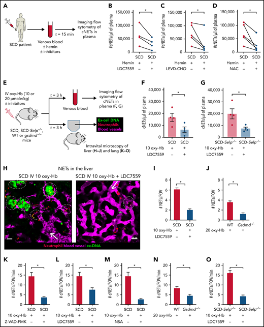 Neutrophil-GSDMD promotes liver-to-lung embolization of cNETs in SCD. (A) Experimental scheme used in panels B-D: SCD patient blood preincubated with 20 μM hemin with or without GSDMD inhibitor (LDC7559) or caspase-4 inhibitor (LEVD-CHO) or NAC, processed to generate PPP, PPP incubated with Sytox green and fluorescent Abs against NE and citrullinated histones (H3-Cit), and cNETs detected in PPP by imaging flow cytometry as described in Figure 2. Concentration of cNETs (#cNETs/μL of plasma) was significantly reduced in hemin-treated SCD patient blood following incubation with (B) 20 µM LDC7559 (n = 4 patients), (C) 20 µM LEVD-CHO (n = 5 patients), and (D) 20 µM NAC (n = 5 patients). Straight line connects cNETs concentrations in the same SCD patient blood pre- (red circle) and post- (blue circle) inhibitor treatment. (E) Experimental scheme used in panels F to O: SCD or SCD-Selp−/− mice and WT or Gsdmd−/− mice were IV administered 10 µmol/kg oxy-Hb (10 oxy-Hb) and 20 µmol/kg oxy-Hb (20 oxy-Hb), respectively, without or with 10 mg/kg GSDMD inhibitor (LDC7559) or 0.004 µmol/kg pan-caspase inhibitor (Z-VAD-FMK) or 20 mg/kg GSDMD inhibitor necrosulfonamide (NSA) or 10 mg/kg GSDMD inhibitor (disulfiram). In panels F-G, venous blood was processed to generate PPP and cNETs detected in PPP using imaging flow cytometry as in panel A. In panels H to O, microcirculation, neutrophils, and extracellular DNA were labeled in vivo by IV administration of FITC or Texas-red dextran, Pacific blue–anti-Ly6G Ab, and Sytox orange or green, respectively, and intravital fluorescence microscopy was used to assess the absence or presence of NETs within the liver (H-J) and lung (K-O) microcirculation. (F) Plasma concentration of cNETs was significantly less in mice with SCD IV administered 10 oxy-Hb + LDC7559 (n = 4 mice) than 10 oxy-Hb alone (n = 4 mice). (G) Plasma concentration of cNETs was significantly less in SCD-Selp−/− mice IV administered 10 oxy-Hb + LDC7559 (n = 4 mice) than 10 oxy-Hb alone (n = 4 mice). (H) Left, representative liver intravital microscopy image and supplemental Video 19 reveal numerous large NETs (marked with white ellipses) and areas with impaired blood flow evident by slow transit of erythrocytes (dark cells) in the liver microcirculation of a mouse with SCD administered IV 10 oxy-Hb. Right, representative liver intravital microscopy image and supplemental Video 20 reveal only a single small NET (marked with white ellipse) and significantly improved blood flow evident by rapidly transiting neutrophils (red) and erythrocytes (dark cells) in the liver microcirculation of a mouse with SCD administered IV 10 oxy-Hb + 10 mg/kg LDC7559. NETs were identified based on colocalization of neutrophil (pseudo-colored red) and extracellular DNA (green) in microcirculation (pseudo-colored purple). Scale bars, 20 µm. Arrow denotes the direction of blood flow. Liver intravital microscopy images were analyzed as in Figure 3 to estimate number of NETs per FOV (#NETs/FOV). (I) #NETs/FOV were significantly less (threefold) in the liver microcirculation of mice with SCD administered IV 10 oxy-Hb + LDC7559 (n = 4 mice; 42 FOVs) than 10 oxy-Hb alone (n = 4 mice; 44 FOVs). (J) #NETs/FOV were significantly less (fourfold) in the liver microcirculation of Gsdmd−/− (n = 4 mice; 35 FOVs) than littermate WT mice (n = 4 mice; 38 FOVs) administered IV 20 oxy-Hb. (K-O) Lung intravital microscopy images were analyzed as in Figure 2 to estimate number of cNETs entering per FOV in the lung over a 1-minute duration (#cNETs/FOV/min). #cNETs/FOV/min in the lung were significantly less in mice with SCD IV administered (K) 10 oxy-Hb + 0.004 µmol/kg Z-VAD-FMK (n = 4 mice; 51 FOVs), (L) 10 oxy-Hb + 10 mg/kg LDC7559 (n = 4 mice; 41 FOVs), and (M) 10 oxy-Hb + 20 mg/kg NSA (n = 3 mice; 38 FOVs) than 10 oxy-Hb alone (n = 4 mice; 44 FOVs). (N) #cNETs/FOV/min in the lung were significantly less in Gsdmd−/− (n = 3 mice; 29 FOVs) than littermate WT mice (n = 3 mice; 33 FOVs) IV administered 20 oxy-Hb. (O) #cNETs/FOV/min in the lung were significantly less (fourfold) in SCD-Selp−/− mice IV administered 10 oxy-Hb + LDC7559 (n = 3 mice; 35 FOVs) than 10 oxy-Hb alone (n = 5 mice; 71 FOVs). A similar effect of disulfiram on #cNETs/FOV/min in the lung of SCD-Selp−/− mice shown in supplemental Figure 22. Data in panels B to D compared using a paired Student t test. Data in panels F, G, and I to O represent mean ± SE and compared using Student t test. *P < .05. FOV size ∼65 536 µm2.