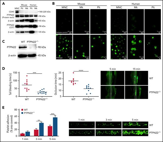 PTPN22 expression in platelets (Plt) and its role in hemostasis and thrombus formation. Human or mouse mononuclear cells (MNC) were isolated and used as positive control. Plt or megakaryocytes (Mk) from WT mouse or platelets from healthy individuals were isolated to measure PTPN22 expression by western blot with 2 different antibodies (A) or immunofluorescent staining (B). (C) PTPN22 expression in PTPN22−/− Plt was measured by western blot. Human megakaryocytic cell line (CMK) was used as human Mk. Data are representative of 3 independent experiments. Scar bar = 10 μm. (D) Tail bleeding time and FeCl3-induced arterial thrombosis in WT and PTPN22−/− mice (mean). Representative image of arterial thrombosis at different time point is shown. (E) Platelet adhesion on collagen under flow conditions. Whole blood was labeled with mepacrine and perfused through fibrillar collagen–coated BioFlux plates (Fluxion Biosciences) at 40 dynes/cm2 for 5 minutes. Platelet adhesion (covered area) was quantified at different time points (mean ± standard error, n = 6; one-way analysis of variance). **P < .01, ***P < .001, ****P < .0001.