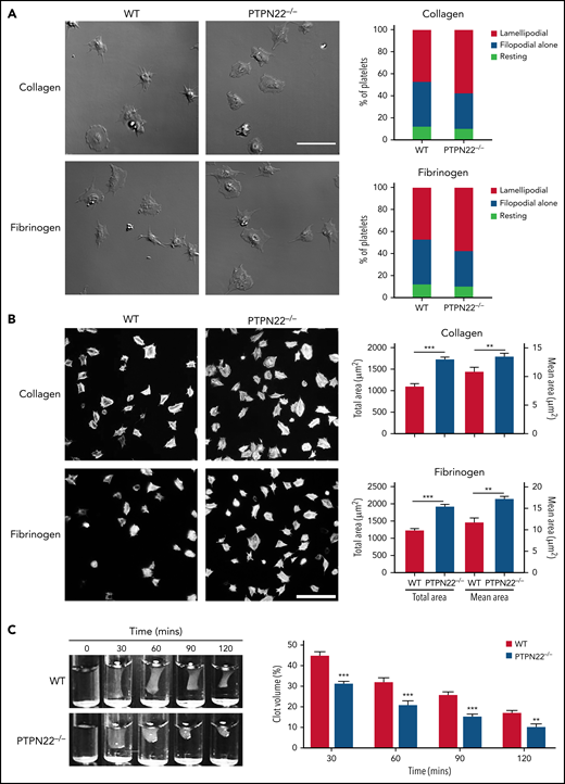 Platelet spreading and thrombin-mediated clot retraction. (A) Platelets (6 × 106/mL) were allowed to spread on collagen or fibrinogen for 20 minutes and fixed, followed by observation of filopodia and lamellipodia formation under a differential interference contrast microscope (Zeiss LSM 880) (×63 oil objective). (B) Platelets (12 × 106/mL) were placed on glass coverslips that were precoated with collagen or fibrinogen at 37°C for 90 minutes and then stained with Alexa Fluor-546–labeled phalloidin followed by analysis of the covered area using ImageJ software (National Institutes of Health). Images (×100) (scale bar = 20 μm) are representative of 3 independent experiments (mean ± standard deviation, n = 3; unpaired t test). (C) Clot retraction was triggered after addition of thrombin (1 U/mL). Representative images at 30, 60, 90, and 120 minutes from 3 independent experiments are presented. Data were quantified as clot volume (%) and are presented as mean (n = 3; two-way analysis of variance). **P < .01, ***P < .001.