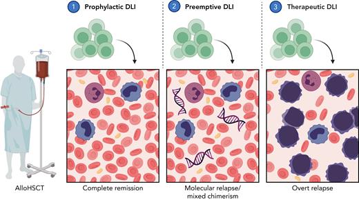 Overview of different strategies to administer DLI. (1) Prophylactic DLI is administered after a defined interval posttransplant to reduce the risk of relapse. (2) Preemptive DLI serves to restore GvL on impending relapse as detected by persisting MRD or LOC. (3) Therapeutic DLI is administered to treat overt hematologic relapse. Abbreviations: DLI, donor lymphocyte infusion; GvL, graft-versus-leukemia effect; LOC, loss of complete donor chimerism; MRD, measurable residual disease. Image created in BioRender.