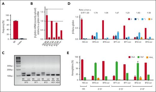 ABE-mediated correction of the IVS1-110 (G>A) mutation in BT HSPCs restores normal Hb production in their erythroid progeny. (A) The frequency of corrected alleles (BE) and indels as assessed by Sanger sequencing in BTHSPCs. Data are expressed as mean ± SEM (3 donors). The frequency of corrected alleles in the cells obtained from the compound heterozygous patient (BT2) was corrected considering only the alleles harboring the IVS1-110 (G>A) mutation. The dotted line represents the maximum background noise of indels calculated by TIDE. (B) RT-qPCR using primers detecting exclusively correctly spliced β-globin mRNAs in erythroid cells derived from BT HSPCs (cor). β-globin expression was normalized to α-globin. Data are expressed as mean ± SEM. The dotted lines indicate the maximum and minimum values observed in HD cells. (C) RT-PCR using primers amplifying a region spanning the HBB exon 1-exon 2 junctions. cDNA was obtained from erythroid cells derived from BT HSPCs (cor). (D) Expression of β-, Gγ-, Aγ- and δ- globin chains measured by RP-HPLC in BT and HD RBCs. β-like-globin expression was normalized to α-globin. The α-/non–α-globin ratio is reported on top of the graph. RBCs were obtained from BT HSPCs (cor). Data are expressed as mean ± SEM. (E) Analysis of HbA, HbF, and HbA2 by CE-HPLC in BT and HD RBCs. We calculated the percentage of each Hb type over the total Hb tetramers. RBCs were obtained from corrected BT HSPCs (cor). (B-C) As controls, we used erythroid cells derived from BT or HD HSPCs electroporated only with SpRY-ABE8e mRNA (BE) (3 patients with BT and 2 HDs). (D-E) As controls, we pooled data obtained in RBCs derived from BT or HD HSPCs electroporated with TE or with SpRY-ABE8e mRNA only (3 patients with BT and 2 HDs). Data are expressed as mean ± SEM. cor, corrected; ctr, control.
