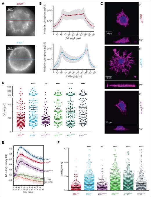 Effect of BTG1 deletion on actin cytoskeleton, cell adhesion, and migration. (A) Representative image and (B) quantification of phalloidin staining of TMD8-BTG1WT and TMD8-BTG1−/− cells on poly-L-lysine–coated slides (n = 10 for each group). (C) Confocal images in vertical (α = 0°) and horizontal (α = 90°) planes of phalloidin (purple) and Hoechst (blue) staining of TMD8-BTG1WT, TMD8-BTG1−/−, and TMD8-BTG1rescue on fibronectin-coated slides, with (D) quantification of TMD8-BTG1WT, TMD8-BTG1−/−, TMD8-BTG1rescue, and TMD8-BTG1rescuemutated cell area (P < .0001, compared with TMD8-BTG1WT, n = 3). (E) Cell index measurement (Xcelligence) after addition of TMD8-BTG1−/− (blue), TMD8-BTG1WT (red), or TMD8-BTG1rescue (purple) on fibronectin-coated or uncoated wells. (F) Quantification of cellular motility of TMD8-BTG1WT, TMD8-BTG1−/−, TMD8-BTG1rescue, and TMD8-BTG1rescuemutated seeded onto fibronectin-coated slides (P < .0001, compared with TMD8-BTG1WT, n = 3). Values represent mean ± SEM; ∗∗∗∗P < .0001, using one-way ANOVA with Dunnett multiple comparisons test in panels D,F. ANOVA, analysis of variance; ns, not significant; SEM, standard error of the mean.