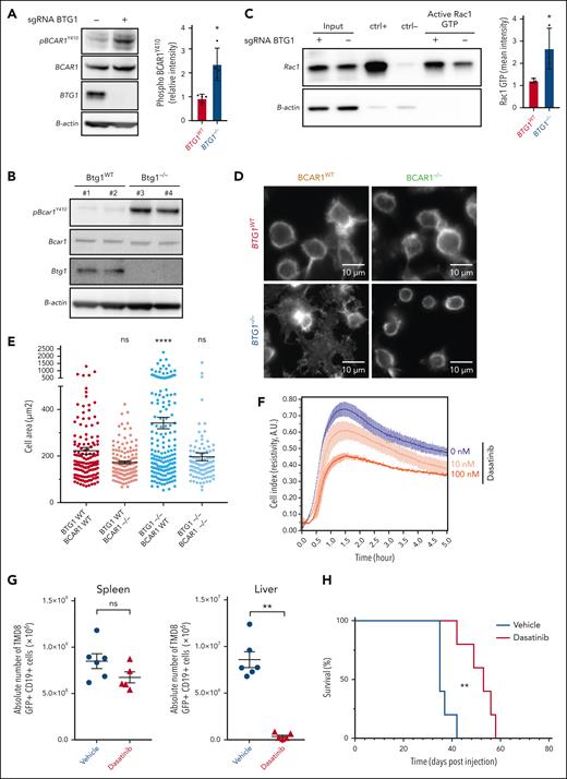 BTG1 inactivation promotes BCAR1 driven dissemination of lymphoma. (A) Representative western blot and quantification of BCAR1Y410 phosphorylation in TMD8-BTG1−/− and TMD8-BTG1WT cells (representative of n = 4 experiments, P < .05). (B) Western blot analysis of BCAR1Y410 phosphorylation of sorted splenic B lymphocytes from Btg1WT or Btg1−/− mice (n = 2 per group). (C) Immunoprecipitation (representative of n = 3 experiments) and quantification of RAC1-GTP in TMD8-BTG1−/− and TMD8-BTG1WT cells (P < .05). (D) Representative confocal images of phalloidin staining and (E) quantification of TMD8-BTG1WT-BCAR1−/−, TMD8-BTG1−/−-BCAR1WT, and TMD8-BTG1−/−-BCAR1−/− cell area on fibronectin-coated slides (P < .0001 compared with TMD8-BTG1WT-BCAR1WT). (F) Resistivity measurement estimated by the cell index (Xcelligence) of TMD8-BTG1−/− cells on fibronectin-coated wells after dasatinib pretreatment (excipient, 0.01 and 0.1 μM for 30 minutes). (G) Flow cytometry quantification of TMD8-BTG1−/− cells in the spleen and liver of recipient NSG mice treated by 5 daily injections of dasatinib (n = 5) or vehicle (n = 6), (P < .01 compared with vehicle). (H) Kaplan-Meier survival probability of NSG mice after intrasplenic injection of TMD8-BTG1−/− cells and treatment with vehicle (blue, n = 5) or dasatinib (orange, n = 5; ∗∗P = .0041). Values represent mean ± SEM; ∗P < .05; ∗∗P < .01; ∗∗∗∗P < .0001; using the Mann-Whitney test in panels A,C,G, one-way ANOVA with Dunnett multiple comparisons test in panel E, and log-rank test in panel H. ANOVA, analysis of variance; ns, not significant; SEM, standard error of the mean.