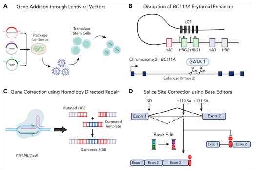 Schematic of various gene therapy strategies to treat β-thalassemia. (A) The use of lentiviral vectors to incorporate a full-length HBB gene or shmiRs targeting BCL11A for the upregulation of HbF. The use of CRISPR/Cas9 machinery can either knock out BCL11A to upregulate HbF (B) or incorporate a corrected HBB cassette with HDR machinery (C). Finally, adenine base editors can be used to convert A to G nucleotides to correct single-point mutations or incorrect splice sites, such as IVS1-110 (D). Created with BioRender.com.