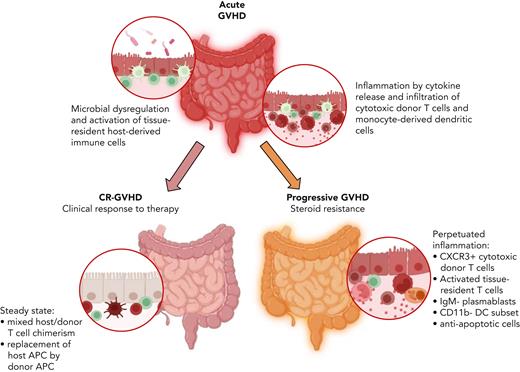 Pathological mechanisms of aGVHD. (Top) Microbial products and cytokines from resident cells (eg, effector T cells, CD163+ monocyte-derived macrophages) are believed to induce GVHD. (Bottom) While complete response to first-line therapy usually induces an equilibrium of host/donor tissue-resident T cells and replacement of host macrophages by donor APCs in barrier tissues, steroid resistance is now shown to be related to the occurrence of CXCR3+ donor T cells, activated tissue-resident T cells, plasmablasts, and dendritic cells. APC, antigen-presenting cells; DC, dendritic cells; IgM, immunoglobulin M. Figure designed by Johanna Strobl and created with BioRender.com.