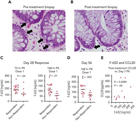 Histology and PK profiles associated with treatment response. (A-B) Representative images of hematoxylin and eosin–stained histopathology performed at the onset of aGVHD and following rhIL-22 treatment with F-652 in a small subset of patients. (A) Pretreatment biopsy: colonic biopsy with crypt injury and extensive epithelial cell apoptosis. Arrows indicate apoptotic cells. (B) Day 28 posttreatment biopsy: colonic mucosa with only rare epithelial apoptotic bodies in basal crypts. Arrow points to a single apoptotic cell. (C) Drug PK levels 3 days and 7 days following the first dose of F-652 were greater in patients who went on to become treatment responders at day 28. (D) Drug PK levels 7 days following the first dose of F-652 were greater in patients who remained treatment responders at day 56. (E) Drug PK levels 7 days following the first dose of F-652 correlated with circulating plasma CCL20 concentrations after completion of F-652 treatment.