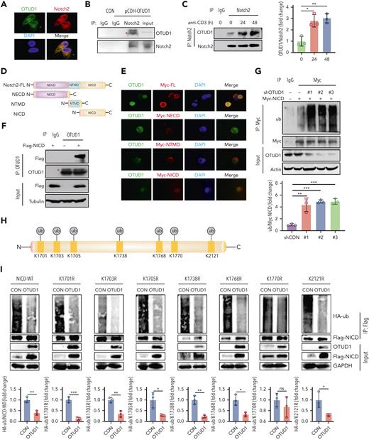 OTUD1 interacts with NICD and cleaves ubiquitin from the K1770 site of NICD. (A) Confocal microscopy was used to analyze colocalization between OTUD1 and Notch2. (B) Jurkat E6.1 cells were transfected with pCDH-OTUD1 plasmids. Notch2 proteins were immunoprecipitated with an anti-Notch2 antibody and then OTUD1 and Notch2 protein levels were analyzed by western blot. (C) Jurkat E6.1 cells were stimulated with anti-CD3 (0.1 μg/mL) antibody for 24 or 48 hours in vitro. Notch2 proteins were immunoprecipitated with anti-Notch2 antibody and then OTUD1 and Notch2 were assessed by western blot. (D) Schematic diagrams of Notch2 full-length and Notch2 different mutants. (E) HEK293T cells were transfected with Myc-Notch2-FL, Myc-Notch2-ECD, Myc-Notch2-TMD and Myc- NICD. The colocalization between Notch2 and OTUD1 were evaluated by confocal. (F) HEK293T cells were transfected with Flag-NICD. OTUD1 proteins were immunoprecipitated with an anti-OTUD1 antibody and then OTUD1 and Flag-NICD were analyzed by western blot. (G) HEK293T cells were transfected with Myc-NICD, shCON or shOTUD1. Myc-NICD proteins were immunoprecipitated with anti-Myc beads and the ubiquitination levels of NICD were evaluated by western blot. (H) Schematic diagram of the ubiquitination K site of NICD protein. (I) HEK293T cells were transfected with Flag-NICD-WT, K1701R, K1703R, K1705R, K1738R, K1768R, K1770R, K2121R, together with pCDH-OTUD1 and HA-ub. Flag-NICD proteins were analyzed by immunoprecipitation and immunoblotting. Data in panels B-C,F-G,I are representative of 3 independent experiments and data in panels C,G,I are summarized as mean ± SD of 3 experiments. FL, full length.