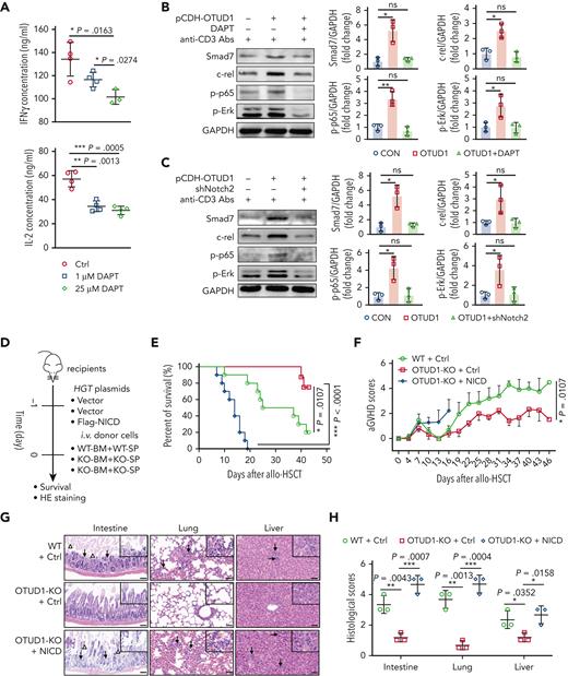 NICD is essential for OTUD1-mediated TCR signaling transduction that accelerates aGVHD progression. (A) CD4+ T cells isolated from C57BL/6 mice were stimulated with anti-CD3 (2 μg/mL) and anti-CD28 (0.4 μg/mL) antibodies and incubated with control (Ctrl) or DAPT (1, 25 μM) for 24 hours in vitro, and then the protein levels of IFN-γ and IL-2 were monitored by ELISA. (B) Jurkat E6.1 cells stably expressing OTUD1 were incubated with anti-CD3 (0.1 μg/mL) antibody and with or without DAPT (5 μM) for 48 hours, and then Smad7, c-rel, p-p65 and p-Erk were assessed by western blot. (C) Jurkat E6.1 cells transfected with pCDH-OTUD1, shCON or Notch2 shRNA (shNotch2) plasmids were stimulated with anti-CD3 (0.1 μg/mL) antibody for 48 hours, and then Smad7, c-rel, p-LCK, p-p65, p-Erk and NFAT were monitored by western blot. (D) A schematic diagram of the mice experiments. (E-F) BM cells (1 × 107 per mouse) and splenocytes (5 × 106 per mouse) isolated from WT or OTUD1−/− mice on B6 background were transferred into lethally irradiated BALB/c mice injected with 80 μg Flag-NICD or Ctrl plasmids (n = 10 for WT + Ctrl group, n = 8 for OTUD1-KO + Ctrl group, n = 10 for OTUD1-KO + NICD group). The survival of aGVHD mice was observed twice 1 day (E), and the aGVHD scores were observed and recorded every 2 days (F). (G) Representative images of intestine, lung and liver of aGVHD mice by HE staining (scale bar, 100 μm; arrows, infiltrating lymphocytes; triangles, apoptotic epithelial cells). (H) Histological scores of intestine, lungs, and liver of aGVHD mice were evaluated. Log-rank (Mantel-Cox) test was used to analyze the survival curve. Data in panels A,H are represented as mean ± SD; ∗P < .05, ∗∗P < .01, ∗∗∗P < .001 (2-tailed unpaired Student t test). Data in panels B,C are representative of 3 independent experiments and are summarized as mean ± SD of 3 experiments.