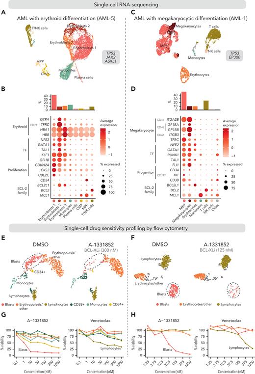 Integrated single-cell transcriptomics and phenotype-based ex vivo drug profiling in AML with megakaryocytic differentiation. (A) Uniform Manifold Approximation and Projection (UMAP) plot of scRNA-seq data of AML with erythroid differentiation (patient AML-5). Cells are colored based on clusters, which are named with the help of the reference-based cell type classification method SingleR. (B) Dot plot of expression of selected erythroid differentiation markers, TFs regulating erythroid differentiation, proliferation and progenitor markers, and BCL-2 family genes in the indicated cell types in the scRNA-seq data of AML with erythroid differentiation (AML-5). CD marker names are shown in gray. Dot size indicates the percentage of cells of a cell type expressing the given gene, and average expression is shown as normalized and scaled log-transformed counts. Bar plot above shows the percentage of each cell type out of all cells. (C) UMAP plot of scRNA-seq data of AML with megakaryocytic differentiation (patient AML-1). Cell types identified using the reference-based method SingleR are colored as indicated in panel D. Cell types comprising less than 1% of total cells are labeled as “Other.” (D) Dot plot of expression of selected megakaryocyte differentiation markers, TFs regulating megakaryocytic differentiation, progenitor markers, and BCL-2 family genes in the indicated cell types in the scRNA-seq data of AML with megakaryocytic differentiation (AML-1) as in panel B. (E) UMAP plots of cells analyzed using flow cytometry-based drug profiling in the patient with AML with erythroid differentiation (AML-5). Cells from control (DMSO) and BCL-XL inhibitor-treated (A-1331852, 300 nM) conditions are shown, with 1000 cells sampled from each condition. (F) UMAP plots of cells analyzed using flow cytometry-based drug profiling in the patient with AML with megakaryocytic differentiation (AML-1). Cells from control (DMSO) and BCL-XL inhibitor-treated (A-1331852, 125 nM) conditions are shown, with 1000 cells sampled from each condition. (G) Viabilities (percentage of viable cells compared with DMSO control) of the clusters representing different cell types in the patients with AML with erythroid differentiation (AML-5) after treatment with indicated concentrations of A-1331852 and venetoclax were analyzed using flow cytometry-based drug profiling. Clusters are colored as in panel E. (H) Viabilities (percentage of viable cells compared with DMSO control) of the clusters representing different cell types in the patient with AML with megakaryocytic differentiation (AML-1) after treatment with indicated concentrations of A-1331852 and venetoclax analyzed using flow cytometry-based drug profiling. Clusters are colored as in panel F. DMSO, dimethyl sulfoxide.