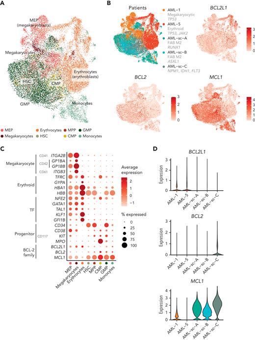 BCL-2 family gene expression in blasts across AML types at single-cell resolution. (A) UMAP plot of scRNA-seq data of blasts from AML with megakaryoblastic differentiation (AML-1), AML with erythroid differentiation (AML-5), and 3 AMLs representing other subtypes. Cell types identified using the reference-based method SingleR are colored. (B) UMAP plots as in panel A with patients and expression of BCL2L1, BCL2, and MCL1 colored as normalized and scaled log-transformed counts. (C) Dot plot of RNA expression of selected megakaryocyte and erythroid markers, TFs regulating erythroid/megakaryocytic differentiation, progenitor markers, and BCL-2 family genes in the indicated cell types based on reference-based method SingleR annotations. (D) Violin plot demonstrating BCL-2 family gene expression of the blasts in different patients.