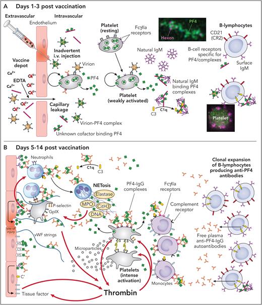 Current concept of the pathogenesis of VITT. The schematic presentation shown in A is speculative and in large part inferred from experiments in HIT. The schematic presentation of the downstream prothrombotic process shown in Panel B is largely substantiated by experimental data, some performed with VITT antibodies, others with HIT antibodies. Modified from Greinacher et al.45 (A) After vaccination, PF4 comes in contact with vaccine constituents and activates B-cells. Left side: It has been proposed that a direct inadvertent breach in the microvasculature at the vaccination site by IV injection or by disruption of vascular endothelial-cadherin tight junctions by EDTA in ChAdOx1, allows vaccine constituents to enter the circulation.45 Within the circulation, adenovirus particles can bind to platelets and can also bind PF4 released by activated platelets or from the matrix coating the microvascular endothelium.46,47 Platelets may become activated by vessel injury caused by injection of vaccine, after binding of the virions to the cell surface, or by immune complexes formed between contaminating host cell-line proteins in the vaccine and natural IgG antibodies against these proteins. Whether the virions themselves or another yet unknown constituent in the vaccine causes a conformational change in PF4 is unknown. Middle: once complexes with PF4 have formed, natural IgM antibodies activate complement (as it has been shown for PF4/heparin complexes),48 which enhances their proximity to B-cell receptors. In a mouse model, IV injection of ChAdOx-1, platelet-bound adenoviral particles are transported to the marginal zone of the spleen where B-cells are activated upon direct contact.49 However, electron microscopy and super resolution microscopy revealed complexes between PF4 and anti-PF4 VITT antibodies with amorphous constituents of the vaccine rather than virus particles.50 Beside the virions, other potential partners for PF4 include unassembled hexons51 and host cell-line proteins, although there is little overlap in the proteins contaminating ChAdOx1 and Ad26.COV2 vaccines.51 Right side: eventually, complexes of PF4 and vaccine (constituents) come in contact with B-cells expressing a cognate Ig receptors for PF4, either as fluid phase complexes, as virion-PF4 complexes, or the complexes are presented by platelets. (B) From right to left. After clonal expansion and isotype switching of one or a few B-cell clones, high titer IgG anti-PF4 antibodies are released into the circulation.52,53 Immune complexes containing PF4 and anti-PF4 IgG cluster and signal through FcRγIIA,50,54 which generates procoagulant platelets, induces platelet/neutrophil aggregates,55 and stimulates NETosis by neutrophils.50,54,56 DNA released by NETosis amplifies immune injury and activates complement, which deposits on the endothelium.57,58 Endothelial cells become activated, expressing tissue factor and releasing von Willebrand factor (VWF). VWF binds PF4 and subsequently anti-PF4 antibodies, which in turn further activates neutrophils and further propagates thrombin generation.59 Professional illustration by Patrick Lane, ScEYEnce Studios.