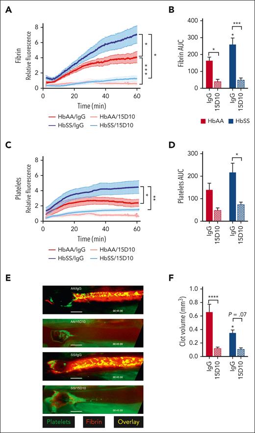 FXII(a) inhibition attenuates femoral vein thrombosis induced by electrolytic injury. Townes HbAA and HbSS mice were treated with IgG or 15D10 (5 mg/kg, IV) 30 minutes before electrolytic injury to the femoral vein. Quantification of (A) relative fibrin intensity over time and (B) the total fibrin fluorescence measured by AUC. Quantification of (C) relative platelet intensity over time and (D) the total platelet fluorescence measured by AUC. Data represent mean ± SEM; n = 6 to 10 mice per group. (E) Representative images of fibrin (red) and platelet (green) accumulation taken 45 minutes after electrolytic injury. (F) Histomorphometric quantification of clot volume. Data represent mean ± SEM of clot volume (mm3); n = 6 to 10 mice per group. ∗P < .05, ∗∗P < .01, ∗∗∗P < .001 by two-way ANOVA and Tukey post-hoc test. ANOVA, analysis of variance; AUC, area under the curve.