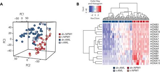Gene expression analysis of dn-NPM1 AML, t-NPM1 AML, dn-AML, and t-AML. (A) Principal component analysis of the most variable genes based on the median absolute deviation. (B) Gene expression of the most variable HOX genes.