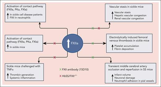 Both humans with SCD and Townes sickle mice demonstrate evidence for FXIIa and contact-pathway factor activation at baseline and display elevated surface FXIIa on neutrophils. TNFα challenge in sickle mice is associated with FXII-dependent activation of the complement pathway of inflammation and the intrinsic pathway of coagulation. Recapitulation of the sickle phenotype by transplantation of HbSS bone marrow into FXII-deficient mice (HbSS/FXII–/–) attenuated these effects. Similarly, genetic FXII deficiency (HbSS/FXII–/–) and treatment with an antibody to FXII (15D10) attenuated vascular stasis, and hepatic and renal congestion in sickle mice challenged with heme to induce vascular stasis, a model mimicking acute VOC in humans with SCD. Infusion of the antibody 15D10 also attenuated electrolytically induced femoral venous thrombosis and reduced stroke infarct volume and neutrophil adhesion in the pial blood vessels of sickle mice. Illustration by Bindu Gopalan.