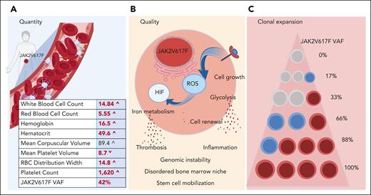 Quantitative, qualitative, and clonal burden in PV. (A) JAK2V617F increases cell quantity by transmitting an excessive growth signal that induces a blood stem cell with the mutation to over produce red blood cells, white blood cells, and platelets. (B) JAK2V617F excessive signaling in cells turns on ROS and HIF, resulting in activation of pathways within the HSC cell, the bone marrow niche, and beyond. (C) JAK2V617F can be present in a single cell as a single copy (heterozygote, blue circle) or as a double copy (homozygote, red circle). Measured JAK2V617F VAF in PV may range from 1% to 100%, depending on relative quantities of the various JAK2V617F genotypes. HIF, hypoxia-inducible factor; ROS, reactive oxygen species.