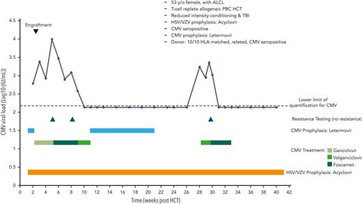 Case 1: viral kinetics, antiviral prophylaxis, treatment, and relevant clinical data of a 55-year-old woman with anaplastic large cell lymphoma (ALCL) undergoing matched-related reduced intensity peripheral blood stem cell transplantation with CMV reactivation. HLA, human leukocyte antigens; PBC, peripheral blood cell; TBI, total body irradiation; VZV, varicella-zoster virus; y/o, years old.