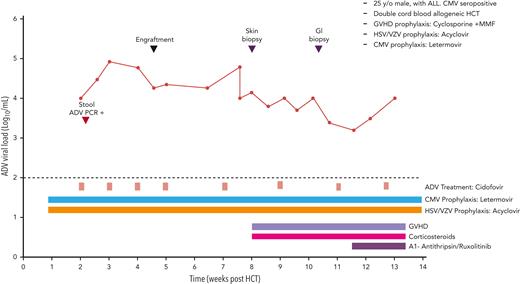 Case 4: viral kinetics, antiviral treatment, and relevant clinical data of a 25-year-old man with ALL undergoing double cord blood transplantation with adenovirus infection. ALL, acute lymphocytic leukemia.