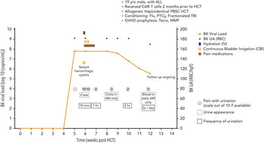 Case 5: viral load, clinical symptoms, and other relevant clinical data of a 19-year-old man with ALL undergoing PBSC transplant and BK virus associated hemorrhagic cystitis. ALL, acute lymphocytic leukemia; CBI, continuous bladder irrigation; IV, intravenous; PBSC, peripheral blood stem cell; RBC, red blood cells; Tacro, tacrolimus; UA, urine analysis.