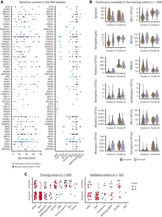 Genetic and clinical characterization of cases from the NIH data set. (A) Germ line variants identified in the NIH data set (n = 399) according to patients’ ages and clinical diagnosis. Variants identified at maximum population frequency of 1% in the general population (gnomAD database) were curated and classified as pathogenic/likely pathogenic (light blue), and as benign, likely benign, or of uncertain significance (VUS; purple). Patients with pathogenic variants in IBMFS genes were labeled as inherited (n = 127). Mutations in genes linked to DBA (n = 9), FA (n = 25), SDS (n = 11), and DC/Hoyeraal-Hreidarsson syndrome (n = 28) were mostly pediatric whereas patients with AA, isolated cytopenias, or MDS/HypoMDS, due to pathogenic variants in telomere biology genes (n = 46) or other genes (RUNX1, n = 1; DDX41, n = 1; and biallelic MPL, n = 1), were in a broader age spectrum. Patients with no variants or with variants classified as benign or likely benign were labeled as acquired (n = 232). In contrast, patients with variants classified as VUS were removed from analysis (n = 40). A final training cohort (n = 359) with 127 labeled as inherited and 232 cases labeled as acquired were used for data modeling. (B) Violin plots of continuous variables in the training cohort (n = 359) according to clusters. Cluster A was enriched for patients who had lower median blood counts, whereas cluster B was enriched for patients with physical anomalies, multiorgan involvement, and long histories of cytopenias or macrocytosis (supplemental Figures 2 and 3). Median ages and blood counts, from both clusters A and B, are shown in the graphic. In general, median blood counts of patients were lower in cluster A than in cluster B and RDW was higher in cluster A than in B, possibly because of enrichment of SAA, which is often transfusion dependent. Within each cluster, inherited cases had lower median ages but higher blood counts. (C) Clinical diagnosis of patients labeled as acquired and inherited in both the training and validation cohorts. Each dot represents a single patient that is colored according to the assigned cluster.