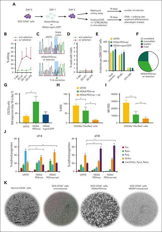 In vitro studies with CD34+ cells from patients with SCD infected with HDAd-PE5max. (A) SCD CD34+ cells (from 3 donors) were infected with HDAd-PE5max or the control virus HDAd-mgmt/GFP at an MOI of 4000 vp/cell or left untransduced (UNTD). On day 3, cells were either plated in Methocult for progenitor colony assays or subjected to ED with or without O6BG/BCNU in vitro selection. (B) Editing rates measured using NGS at various time points after transduction and in vitro differentiation with or without selection. (C) DNA chromatograms from Sanger sequencing showing target site T>A conversion in cells of donor #3 after ED. (D) Percentage of reads with indels. (E) Number of progenitor colonies formed from 2000 plated CD34+ cells (counted at day 14 of culture). BFUE, blast-forming units-erythroid; CFU-GM, granulocyte-macrophage colony–forming unit. (F) Editing measured using Sanger sequencing in donor #3 progenitor colonies after HDAd-PE5max transduction and selection (n = 111). (G) Fold expansion of total cell at day 18 of ED vs day 7 of ED. N = 3 donors. (H and I) Flow cytometry for ROS at day 18 of ED of untransduced cells and cells transduced with HDAd-PE5max without and with O6BG/BCNU in vitro selection (sel). (H) Percentage of ROS-positive cells. (I) ROS mean fluorescence intensity. (J) Percentage of erythroid progenitors counted on cytospins from differentiated SCD CD34+ cells at days 14 and 18 of ED, untransduced (UNTD) and HDAd-PE5max–transduced without and with selection. Two scientists counted 5 random fields. (K) Smears of total blood cells subjected to a sodium metabisulfite sickling assay. Pictures shown here are from day 18 of ED. The scale bar is 25 μm. ∗P < .05. Statistical significance was assessed using one-way ANOVA with Šidák’s multiple comparisons test to calculate P values. Baso, basophilic erythroblasts; dpt, days post transduction; Diff, in vitro ED; mat. Ortho, maturing orthochromatic erythroblasts; Ortho, orthochromatic erythroblasts; Poly, polychromatic erythroblasts; Pro, proerythroblasts; Pyrcs, pyrenocytes; Retics, reticulocytes.