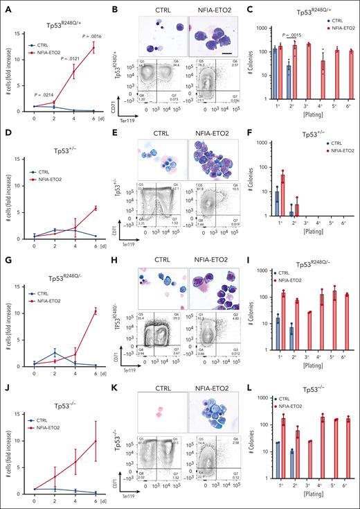 Functional cooperation of NFIA-ETO2 with TP53R248Q in vitro. (A,D,G,J) Growth curves of TP53R248Q/+ (A), Tp53+/− (D), TP53R248Q+/− (G), and Tp53−/− (J) BM-derived EBs expressing NFIA-ETO2 (red line) compared with CTRL cells (blue line) over 6 days in DM (n = 2-3). (B,E,H,K) Representative images of Wright-Giemsa-stained cytospin preparations (top) and flow cytometry panels showing CD71/Ter119 expression (bottom) of TP53R248Q/+ (B), Tp53+/− (E), TP53R248Q/− (H), and Tp53−/− (K) BM-derived EBs expressing NFIA-ETO2 compared with CTRL grown in MM (left) and in DM (right). Data represent 1 out of 2 to 3 independent experiments. Images were recorded with a 60× objective using a Nikon-TI. Scalebars, 50 μm. (C,F,I,L) Colony formation in MC by TP53R248Q/+ (C), Tp53+/− (F), TP53R248Q/− (I), and Tp53−/− (L) BM-derived EBs expressing NFIA-ETO2 compared with CTRL. Shown are absolute numbers of colonies formed in 6 consecutive platings (n = 2-3). Note that control cells cannot self-renew after 2 rounds of plating. Values are presented as individual points, bar graphs represent the mean value of independent biological replicates (n); and error bars are standard error of the mean. Statistical significance was tested with paired two-tailed t tests.