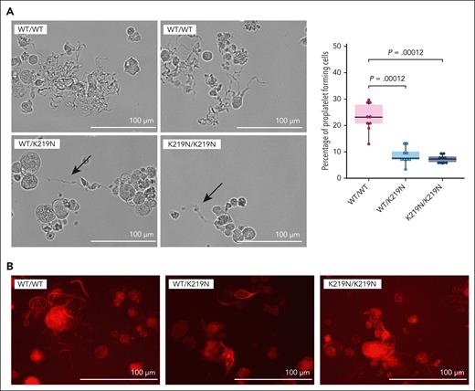 SLFN14-deficient MKs display reduced proplatelet formation. (A) Representative brightfield microscopy images illustrating proplatelet formation on differentiation day 5 in WT/WT, WT/K219N, and K219N/K219N cells (left). Proplatelets formed in WT/K219N and K219N/K219N cells are shorter and with a reduced ramification compared with those formed in WT/WT cells (arrows). Imaging was performed on cells at passage week 5 for WT/WT and WT/K219N, and week 3 for K219N/K219N. Quantification of proplatelet-forming cells on day 5 for 3 independent differentiations shows a significant decrease in both WT/K219N and K219N/K219N cells compared with WT/WT (right). On average, 133, 114, and 120 total number of cells were counted for WT/WT, WT/K219N, and K219N/K219N cells, respectively. Statistics performed with a pairwise Wilcoxon test. Boxplots represent the middle 50% of the data points with 25% outliers as whiskers and the mean as a black horizontal line. All individual data points were added as dots to the graph. (B) SiR-tubulin in vivo staining of day 5 differentiated MK shows the presence of shorter proplatelets with reduced ramification for WT/K219N and K219N/K219N conditions compared with WT/WT MK (representative images from a blinded assay). Scale bars, 100 μm.