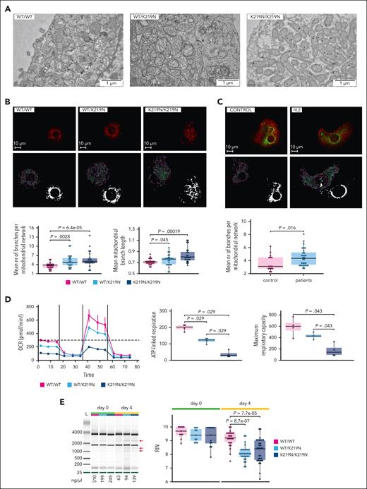 SLFN14-deficient MKs show a mitochondrial defect. (A) Transmission EM imaging of differentiation day 3 MK cells shows abnormal mitochondria in SLFN14-deficient MK compared with WT/WT MK. Images taken after a blinded analysis of MK at passage week 17 for WT/WT and WT/K219N and week 3 for K219N/K219N. (B) Confocal imaging of day 4 MK cells from WT and mutant imMKCL with MitoTracker Red to visualize (top) and quantify (bottom) mitochondria. Imaging performed at passage week 6 for WT/K219N and K219N/K219N, and week 13 for WT/WT. Quantification of the mean number (nr) of branches per mitochondrial network (bottom left) and mean mitochondrial branch length (bottom right) as calculated by the Mitochondrial Network Analysis software for 25 randomly selected MK containing a single nucleus for each condition. P values were determined using the pairwise Wilcoxon test for all comparisons. (C) Confocal imaging of day 8 MK from blood-derived stem cells using the ATP5E antibody (green) to visualize (top) and quantify (bottom) mitochondria. Phalloidin staining in red. Quantification of the mean number of branches per mitochondrial network (bottom) as calculated by the Mitochondrial Network Analysis software for 25 randomly selected MK containing a single nucleus for each condition. P values were determined using the Wilcoxon test. (D) OCR measurements were obtained over time (minutes) using the extracellular flux analyzer from Seahorse Bioscience for WT/WT, WT/K219N, and K219N/K219N MK on day 4 (left). Values represent the mean and standard deviation for each condition of the Seahorse assays obtained for 4 replicates from 2 differentiation experiments. The mitochondrial stress test was used to obtain diverse parameters: ATP-linked OCR (by adding the ATP synthase inhibitor oligomycin), maximal OCR (by adding the uncoupling agent FCCP), and complete inhibition of the mitochondria (by adding the inhibitor antimycin) (right top). The maximal respiration capacity and ATP-linked respiration were significantly reduced for WT/K219N and K219N/K219N MK compared with WT/WT MK (right). Statistics using a pairwise Wilcoxon test was performed. Boxplots in all panels represent the middle 50% of the data points with, 25% outliers as whiskers and the mean as a black horizontal line. All individual data points were added as dots to the graph. (E) Representative gel electrophoresis image showing rRNA degradation fragments (red arrows) for day 4 differentiated WT/K219N and K219N/K219N MK that are not present in WT/WT MK or undifferentiated cells (left). Experiments performed at passage week 5 for day 0 and week 7 for day 4. The concentration of total RNA (ng/μL) for the different samples was added below the figure. Quantification of the RIN values obtained for RNA samples of imMKCL cells from 4 (day 0) and 9 (day 4) independent differentiation experiments on days 0 and 4 WT/WT, WT/K219N, and K219N/K219N MK (multiple technical replicates included per time point per condition) (right). Experiments performed at passage weeks 2, 3, 4, 5, 7, 9, 12, 23, and 25. Boxplots represent the middle 50% of the data points with, 25% outliers as whiskers and the mean as a black horizontal line. All individual data points were added as dots to the graph. Statistical analyses were performed using the pairwise Wilcoxon test for all comparisons. Scale bars, 1 μm (A) and 10 μm (B-C).