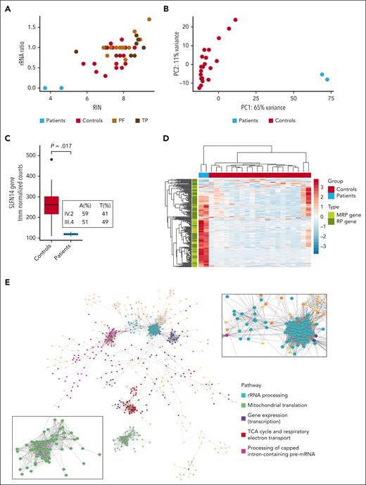 Platelet RNA-seq analysis shows extensive gene expression differences with upregulation of translation and transcription pathways in SLFN14 K219N carriers. (A) Dotplot showing the RIN value vs rRNA ratio of platelet RNA-seq samples from SLFN14 patients IV.2 and III.4, 19 healthy controls, and 26 unrelated, undiagnosed patients with a platelet function (PF) defect or TP. (B) Principal component (PC) analysis plot based on the top 500 genes with the highest variance among samples. (C) Boxplot showing tmm-normalized counts for SLFN14 in patients IV.2 and III.4 and 20 controls as detected by total RNA-seq. Boxplots represent the middle 50% of the data points with, 25% outliers as whiskers and the mean as a black horizontal line. (D) Heatmap showing tmm-normalized counts for all expressed (>10 reads on average in the control group) mitochondrial (M) RPGs and RPGs in patients IV.2 and III.4 and controls. Statistics were performed using the Wilcoxon test. (E) A gene-gene association network for all significantly upregulated genes (log2 fold change >1, false discovery rate <0.05) in platelets from patients IV.2 and III.4, created in Cytoscape. Five subnetworks among the 2762 nodes were identified in the largest connected network. The zoom-in images show the mitochondrial RPGs (green) and RPGs (light blue). TCA, tricarboxylic acid.
