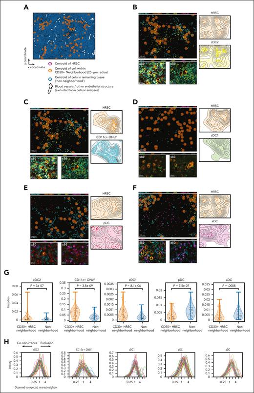 pDCs and aDCs are excluded from the HRSc microenvironment but immunosurveillant cDC1s and cDC2s are enriched. (A) In total, 54 unique tumors were examined by multiplexed, immunofluorescence image analysis. A representative region from CHL-13 is shown, which measures 2008 μm (x-axis) by 1502 μm (y-axis). The centroid of each cell is identified with a colored circle. The CD30+ HRSCs are indicated by a magenta circle. The cell nuclei, which lie within a 10-to-25-μm radius from each HRSC centroid (HRSC neighborhood) are indicated by orange circles and those nuclei beyond the 25-μm areas (nonneighborhood) are indicated by blue circles. Blood vessels/other endothelial structures are indicated (white) and all cells encompassed within these areas are excluded from analysis. (B-D) Spatial distribution of DC subtypes that cooccur with HRSCs. For each phenotype a representative tumor region is identified and shown in all plots: (B) cDC2 (CD11c+ CD1c+) = represented by CHL-13. (C) CD11c+ ONLY cells = CHL-43. (D) cDC1 = CHL-31. (E-F) Spatial distribution of DC subtypes that are “excluded” from HRSCs. For each phenotype a representative tumor region is identified and shown in all plots: (E) pDC = CHL-11. (F) aDC / LAMP3+ = CHL-13. A cropped, illustrative area from each tumor region (measuring 1004 μm by 751 μm, left) is shown as a cell map; phenotyped cells are identified by colored nuclei, with each cell type represented by a different color. CD11c+ ONLY (cyan), CD30+ HRSCs (light orange), cDC1 (green), cDC2 (yellow), LAMP3+ aDCs (magenta), and pDCs (red) are shown. Cells with no assigned phenotype (null) and CD1c+ ONLY cells are excluded from this visualization. The HRSC neighborhood is shown as circles surrounding each CD30+ HRSC (dark orange), each circle extending to a radius of 25 μm around each HRSC. Topological maps of the corresponding full ROI (2008 μm by 1502 μm) of HRSCs (orange, upper right), immune cells of interest (colored based on cell phenotype, lower right). Representative immunofluorescence images (original magnification ×80), showing cells of interest (second line). CD11c (cyan), CD30 (orange), CADM1 (green), CD1c (yellow), LAMP3 (magenta), and CD123 (red) fluorescent signals are represented by unique pseudocolors. To improve visualization, certain signals may not be shown in each particular image (these excluded colors are shown in gray in each respective key). (G) Violin plots comparing the observed cell proportions for each tumor sample (n = 54) for the CD30+ HRSC neighborhood (orange) and across the entire examined tissue area (nonneighborhood; blue), for each DC subtype. Statistical significance: QQ plots showed that the differences in cell proportions between the CD30 neighborhood and the entire sample were not normally distributed, therefore a Wilcoxon signed-rank test was used to assess statistical significance for each phenotype. (H) Histograms showing the distance from each HRSC to its nearest neighbor of an immune-phenotype (n = 54). Distance is shown as a ratio to the expected distance if the immune cell was distributed randomly within the tissue section, with values less than 1 (left of dotted line) indicating that cells cooccur with HRSCs and values >1 (right of dotted line) indicating that cells are excluded from HRSC.s