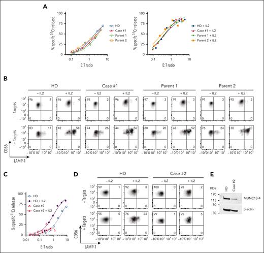 Cytotoxic activity of NK cells from cases #1 and #2. (A) Case #1 (4 years after HSCT, showing 8% donor chimerism), his parents and unrelated healthy donor PBMCs were cultured overnight in the absence (left) or presence of 100 IU/ml of recombinant human (rh) IL-2 (right). The cytotoxic activity of NK cells was assessed against K562 target cells using 51Cr-release assay. Patients’ NK cells show similar activity to his parents and a healthy control despite the loss of donor chimerism. The assay was standardized with respect to the NK-cell percentage in PBMCs (CD3-/CD16+/CD56dim). (B) Case #1 NK cells show normal levels of degranulation as measured by LAMP-1/CD107a externalization in the presence of K562 target cells. (C) Case #2 PBMCs were incubated overnight in the absence or in the presence of 100 IU/mL of rh IL-2, and NK-cell cytotoxicity was assessed by 51Cr-release assay. The assay was standardized as in panel A. (D) Case #2 NK-cell degranulation was measured by LAMP-1/CD107a externalization using K562 as target cells. (E) Western immunoblotting, performed under reducing conditions, shows reduced MUNC13-4 expression in the isolated T cells from case #2, compared to a healthy donor control. PBMCs, peripheral blood mononuclear cells.