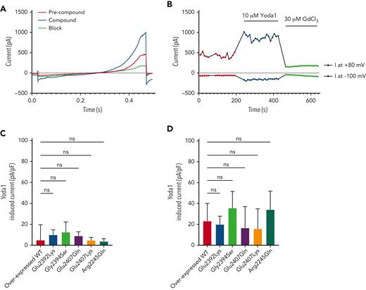 Evaluation of Piezo1 activity in BEL-A overexpressed wild-type and mutant cells using patch clamp. Raw traces of current amplitudes (A) and time course of the experiment (B) at 80 and −100 mV from an example overexpressed wild-type (WT) Piezo1 cell obtained before (precompound, red trace/symbols) and after (compound, blue trace/symbols) addition of 10 μM Yoda1, using a voltage ramp protocol (−100 to 80 mV, 400 ms, holding potential −30 mV) and inhibited by 30 μM GdCl3 (block, green trace/symbols). (C) Evaluation of current increase on Yoda1 addition (Yoda1 induced current, IYoda1− IES, pA/pF) of responding/nonresponding cells identified from BEL-A overexpressed wild-type and mutant Piezo1 constructs (n = 11/77 overexpressed WT; n = 21/84 Glu2392Lys; n = 13/80 Gly2394Ser; n = 15/89 Glu2407Gln; n = 15/80 Glu2407Lys; n = 19/85 Arg2245Gln). (D) Evaluation of current increase on Yoda1 addition in the presence of TRAM-34 (Yoda1 + TRAM-34 induced current, IYoda1− IES, pA/pF) of responding cells identified from BEL-A overexpressed wild-type and mutant Piezo1 constructs (n = 48/82 overexpressed WT; n = 54/86 Glu2392Lys; n = 62/87 Gly2394Ser; n = 47/93 Glu2407Gln; n = 47/77 Glu2407Lys; n = 45/84 Arg2245Gln).