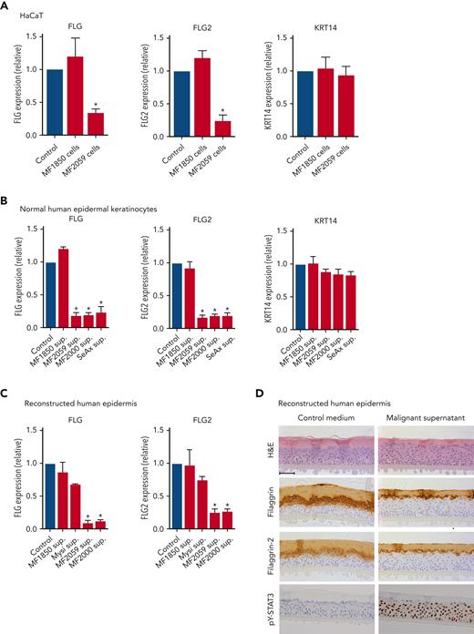 Malignant T cells induce alterations in the epidermis. Messenger RNA (mRNA) expression was analyzed by quantitative PCR (qPCR), using β-actin as a reference gene in panels A-C. Gene expression was given as relative expression. (A) HaCaT cells were cultured for 24 hours with the nonmalignant MF1850 or malignant MF2059 T-cell line. (B) NHEK were cultured for 24 hours with supernatants obtained from the T-cell lines MF1850, MF2059, MF2000, and SeAx. (C) RHE samples were cultured in the presence of supernatants for 24 hours. (D) Protein levels were analyzed by IHC for RHE samples cultured for 48 hours with supernatants from the malignant T-cell line MF2059. The samples were stained for H&E, filaggrin, filaggrin-2, and pY-STAT3. Images are scanned by the Zeiss Axio Scan.Z1 with original magnification ×20. Scale bar; 50 μm. n = 3. ∗P < .05. KRT14, keratin protein 14; sup, supernatant.