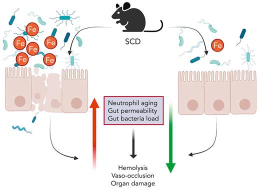 Iron restriction attenuates SCD pathologies in a mouse model. Iron plays a critical role in the pathogenesis of mouse SCD. Dietary iron restriction ameliorates neutrophil aging, gut epithelial disruption, and microbiota alteration, all of which impact SCD morbidities.